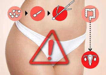 candidosi-vaginale candidosi-vaginale